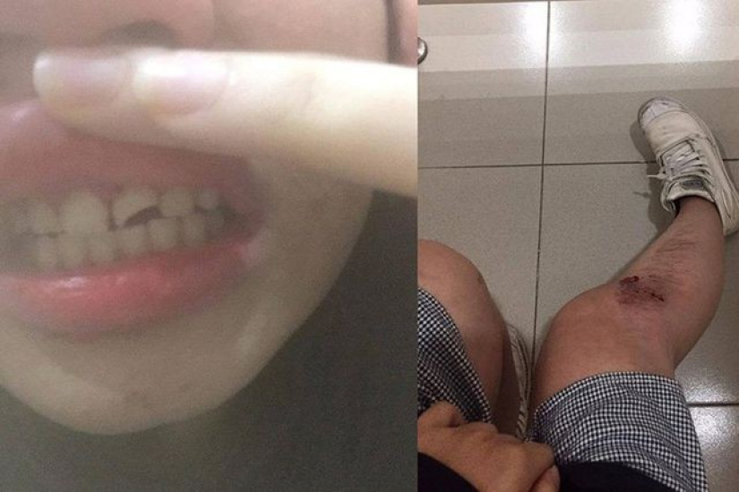Lợi dụng tai nạn, đối tượng bị tình nghi xâm hại các cô gái trẻ tại Hà Nội